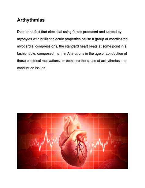 Arthythmias - The etiology, causes, pathology and treatment plans of ...
