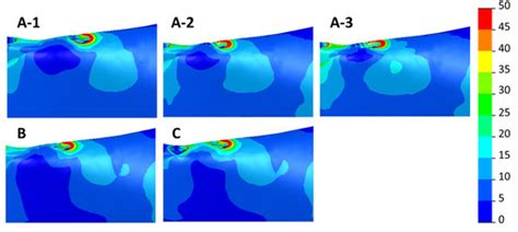 Implant-Supported Prostheses in the Edentulous Mandible: Biomechanical ...