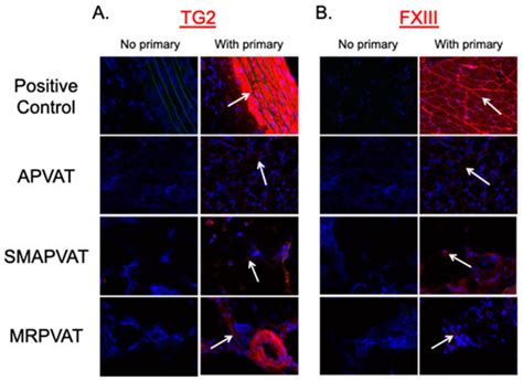 Transglutaminases Are Active in Perivascular Adipose Tissue