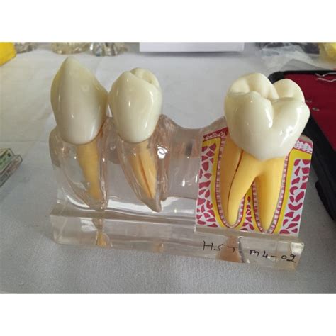 Study Model ( 4 times disassembling ) Hst-M4 - Dentalmart