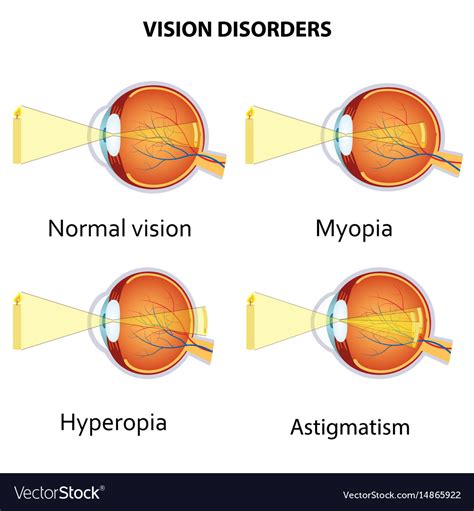 Types of Vision 的图像结果