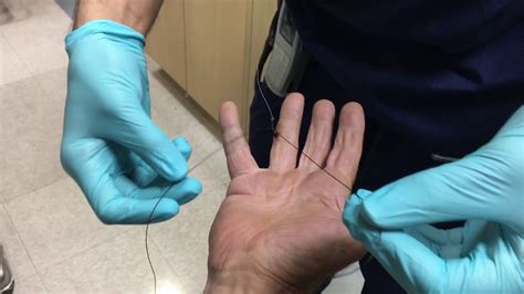 Image result for String Pull Method Fish Hook Removal