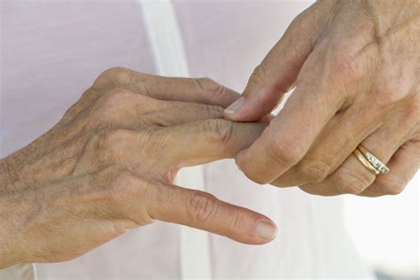 Jammed Finger: At-Home and Medical Treatments