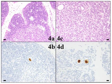 Cytomegalovirus DNA Loads in Organs of Congenitally Infected Fetus