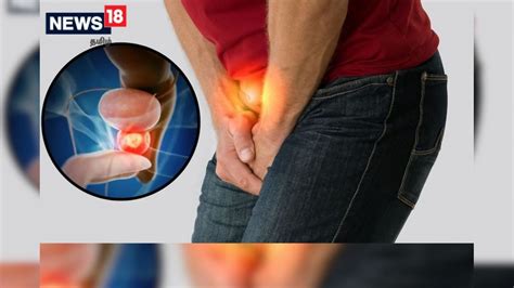 புரோஸ்டேட் புற்றுநோயின் மூன்று நிலைகளை பற்றி தெரியுமா..? அறிகுறிகளும் ...