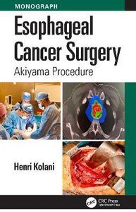 Esophageal Cancer Surgery: Buy Esophageal Cancer Surgery by Kolani ...