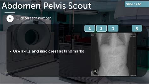 CT Scan Course 的图像结果