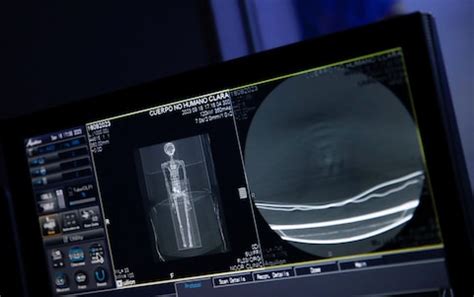 Image result for Alien Belly Probe