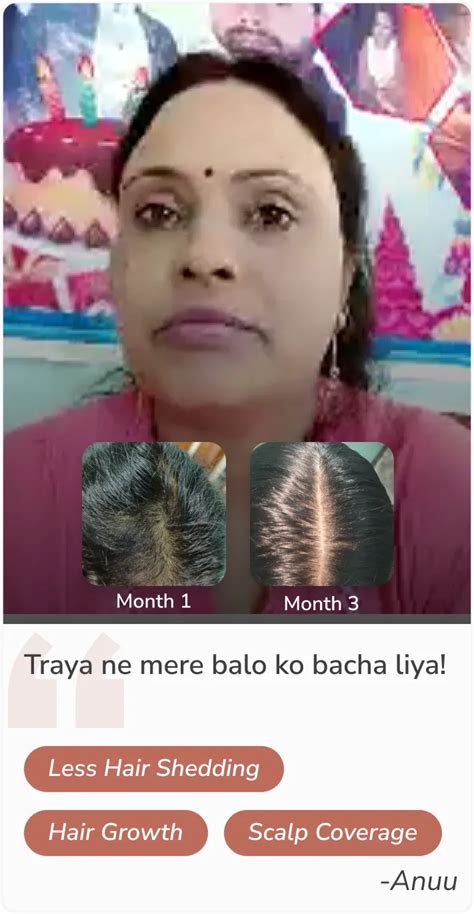Hair Loss Treatment for Women - Holistic Hair fall Solutions for ...