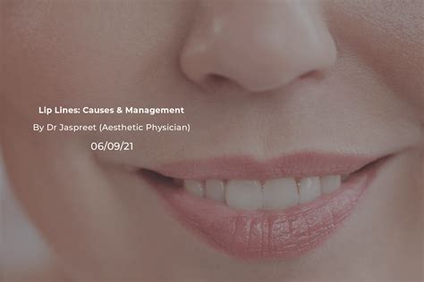 Lip Lines Causes & Management | Cult Aesthetics Dermatology
