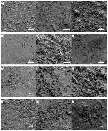 Assessment of Microstructure and Release of Fluoride Ions from Selected ...