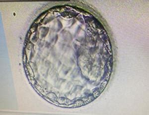 Test Tube Baby Center