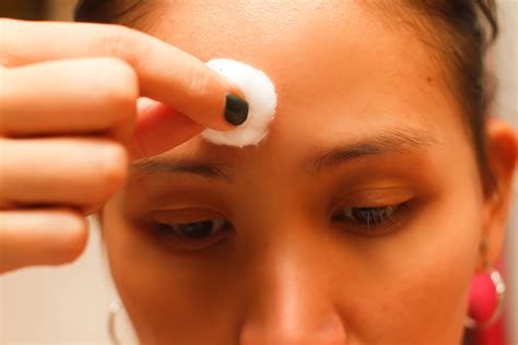 Blackheads On Forehead Removal