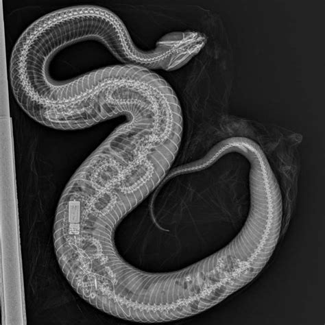 Image result for Python Snake Endoscopy