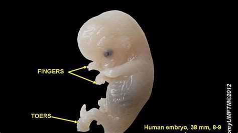 Foot Fetus Definition at Margaret Ratliff blog