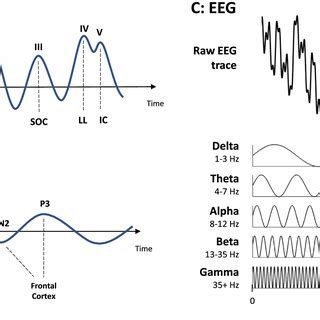Process Models of the Auditory System 的图像结果
