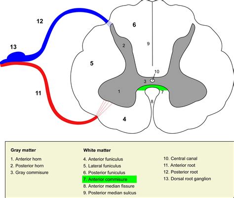 Anterior white commissure - wikidoc