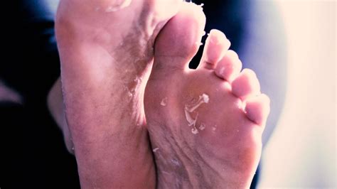 Athlete's Foot Symptoms Australia at Norman Nelson blog