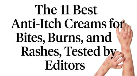 The 11 Best Anti-Itch Creams for Bites, Burns, and Rashes, Tested by E ...
