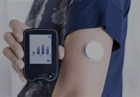 Identify Treatment Gaps with CGM: Comprehensive Guide