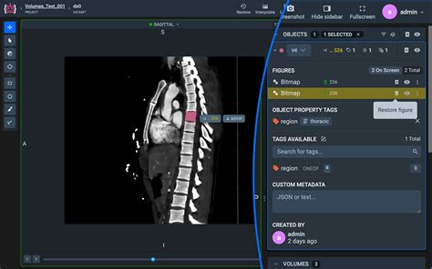 DICOM Query Retrieve Tool 的图像结果