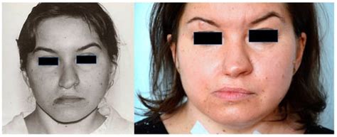 Diagnostics | Special Issue : Maternal-Fetal Medicine