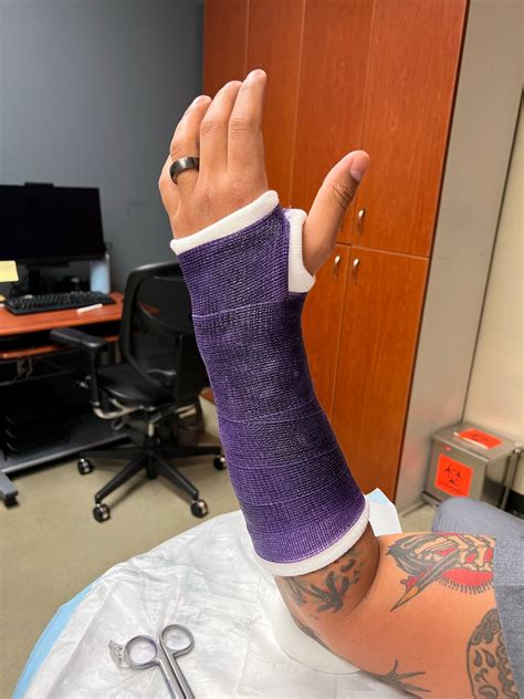 Sophia Caponigro on LinkedIn: Did my first short arm cast today It was ...