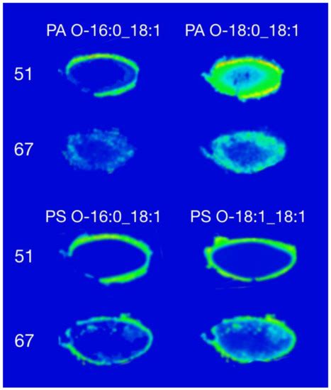 Distribution of Glycerophospholipids in the Adult Human Lens
