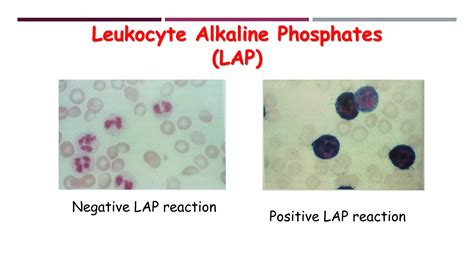 Leukocyte Alkaline Phosphatase Stain | PDF