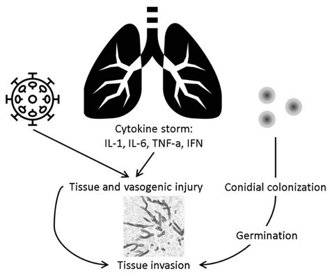 Invasive Pulmonary Aspergillosis in Patients with SARS-CoV-2 Infection ...