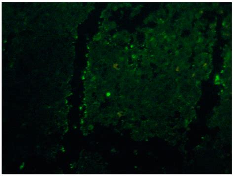 Sporotrichosis: From KOH to Molecular Biology