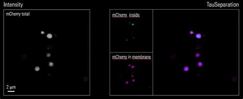 Cell Biology Image Gallery | Learn & Share | Leica Microsystems