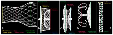 High-Fidelity MicroCT Reconstructions of Cardiac Devices Enable Patient ...