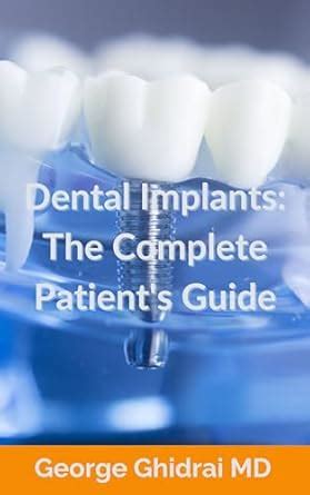 Dental Implants: The Complete Patient's Guide eBook : Ghidrai, George ...
