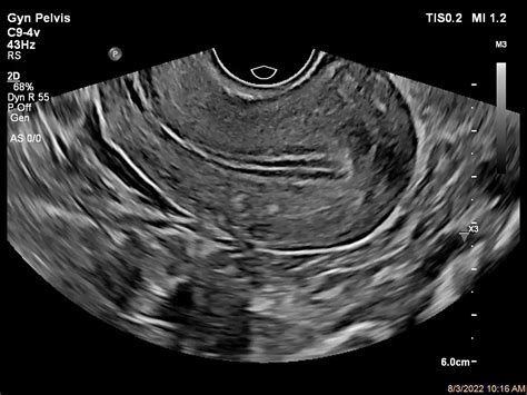 Philips - C9-4v Broadband tightly curved array transducer