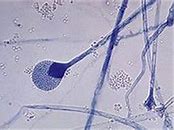孢子囊 的图像结果