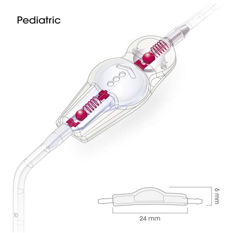 Ventriculoperitoneal Shunts