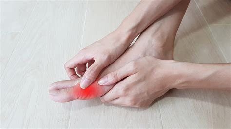 What is the Difference Between Gout vs Bunion? | The Bunion Cure
