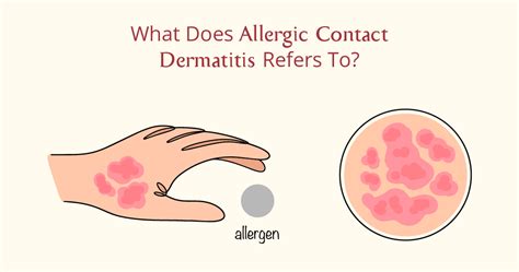 Skin Allergy on Face: Causes, Symptoms, and Effective Treatments – AreoVeda