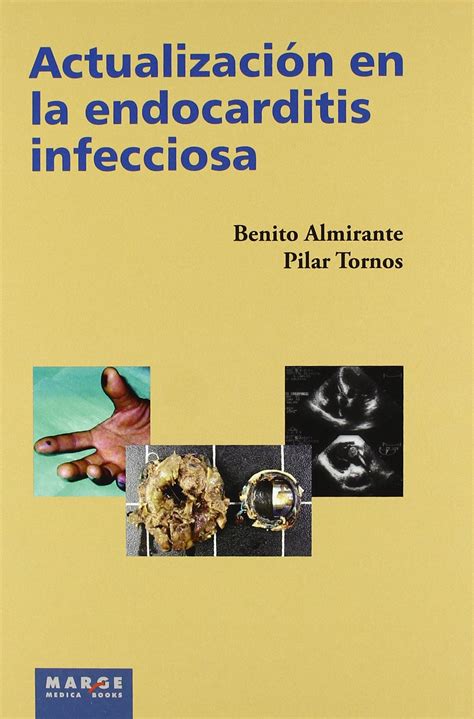 Buy Actualización en la endocarditis infecciosa Online at desertcartINDIA