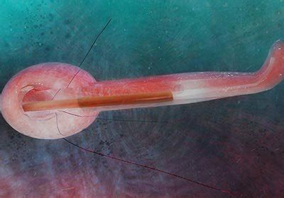 3D Medical & Scientific Animation & Virtual Reality Medical Application