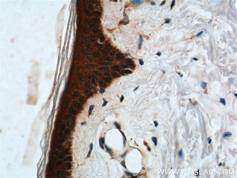 ST3GAL3 antibody (24925-1-AP) | Proteintech