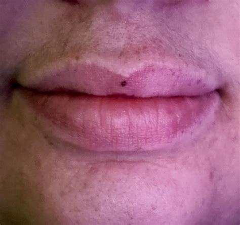 "You got something on your lip" Freckle placement. : r/mildlyinteresting