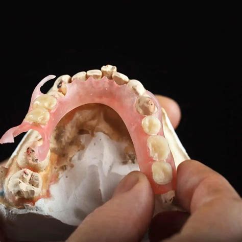 Image result for Bottom Front Teeth Partials