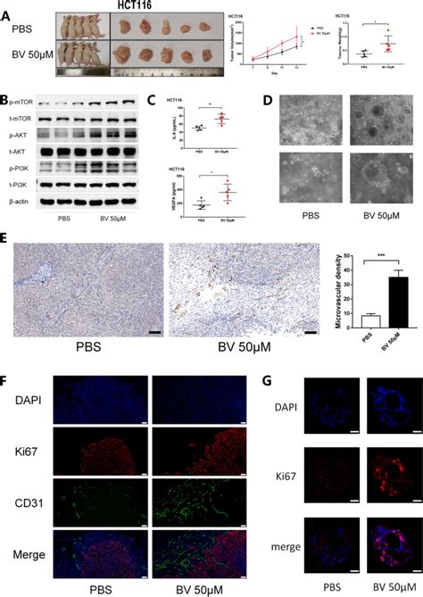 Image result for Enterococcus Faecalis Colon Cancer
