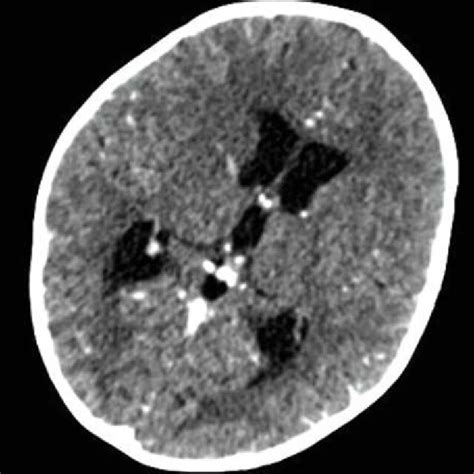Image result for Cat Computerized Axial Tomography Machine