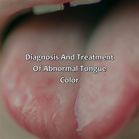 What Does The Color Of My Tongue Mean - colorscombo.com