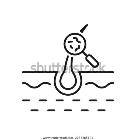 Scalp Parasites 的图像结果