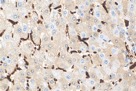 IBA1 antibody (81728-1-RR) | Proteintech