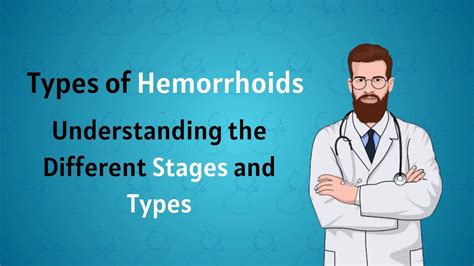 Types of Hemorrhoids - Understanding the Different Stages and Types